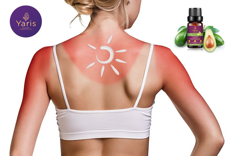 Tác dụng của tinh dầu bơ từ A đến Z